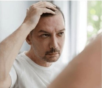 علاج-تساقط-الشعر